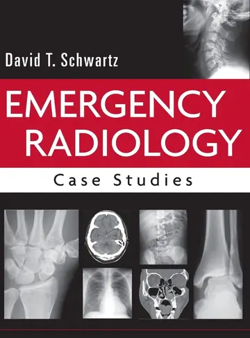 Cover of Emergency Radiology