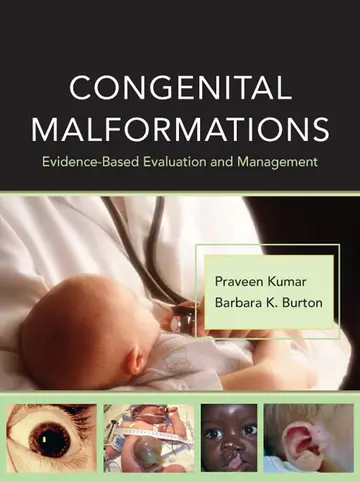 Cover of Congenital Malformations