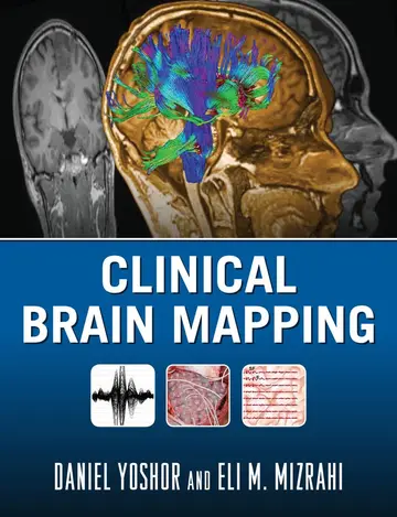 Cover of Clinical Brain Mapping