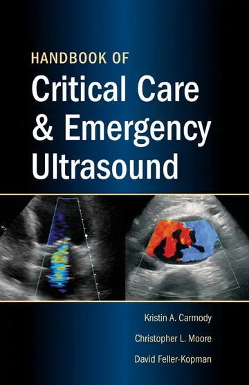 Cover of Handbook of Critical Care and Emergency Ultrasound