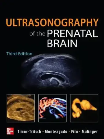 Cover of Ultrasonography of the Prenatal Brain