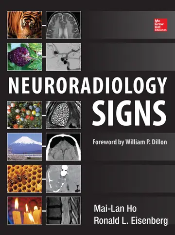 Cover of Neuroradiology Signs