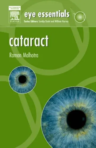 Cover of Cataract