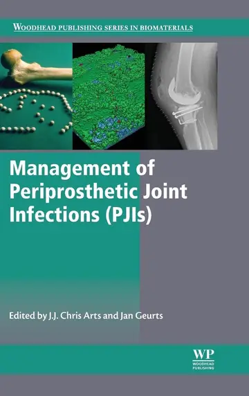 Cover of Management of Periprosthetic Joint Infections