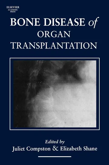 Cover of Bone Disease of Organ Transplantation