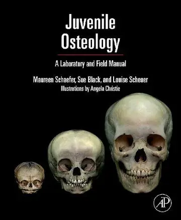 Cover of Juvenile Osteology