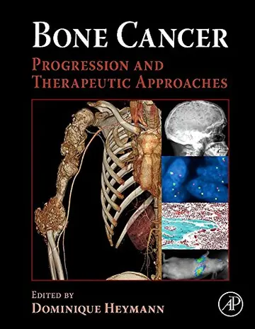 Cover of Bone Cancer