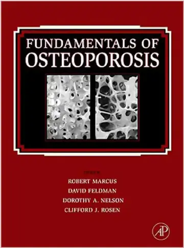 Cover of Fundamentals Of Osteoporosis
