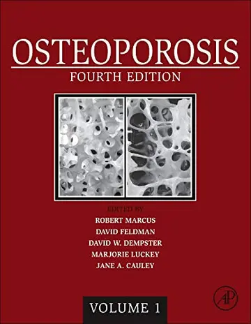 Cover of Osteoporosis