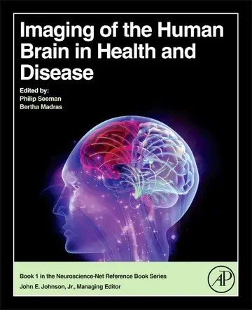 Cover of Imaging of the Human Brain in Health and Disease