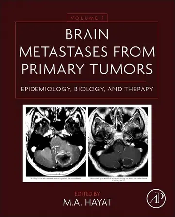 Cover of Brain Metastases from Primary Tumors