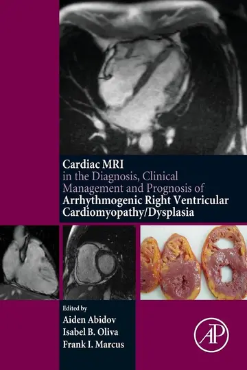 Cover of Cardiac MRI in Diagnosis, Clinical Management, and Prognosis of Arrhythmogenic Right Ventricular Cardiomyopathy/Dysplasia