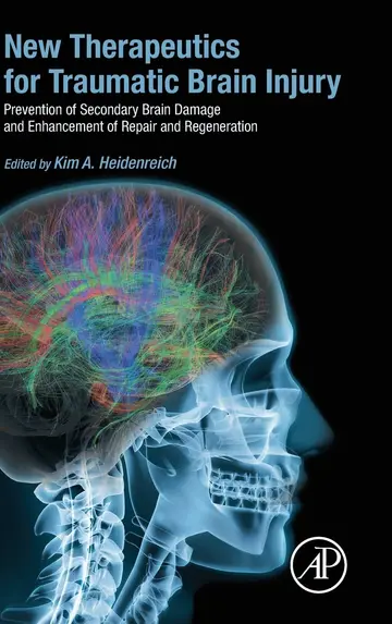 Cover of New Therapeutics for Traumatic Brain Injury