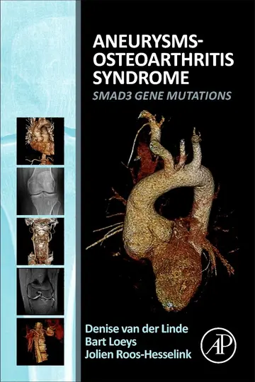 Cover of Aneurysms-Osteoarthritis Syndrome
