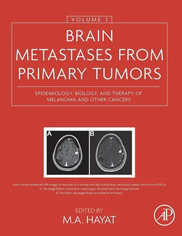 Cover of Brain Metastases from Primary Tumors