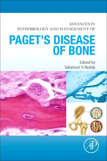 Cover of Advances in Pathobiology and Management of Paget’s Disease of Bone