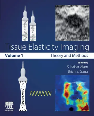 Cover of Tissue Elasticity Imaging