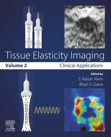 Cover of Tissue Elasticity Imaging