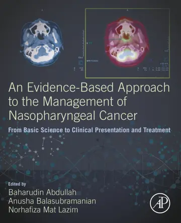 Cover of An Evidence-Based Approach to the Management of Nasopharyngeal Cancer