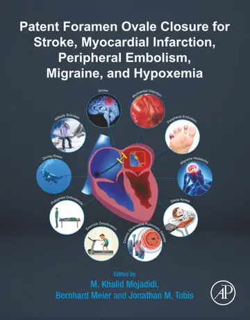 Cover of Patent Foramen Ovale Closure for Stroke, Myocardial Infarction, Peripheral Embolism, Migraine, and Hypoxemia