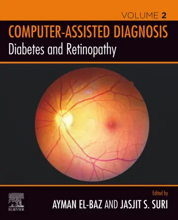 Cover of Diabetes and Retinopathy (Computer-Assisted Diagnosis)
