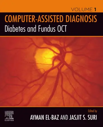 Cover of Diabetes and Fundus OCT