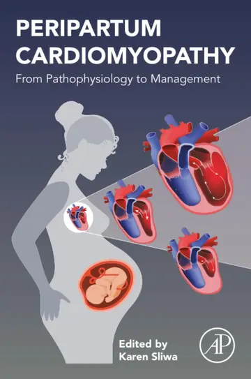 Cover of Peripartum Cardiomyopathy