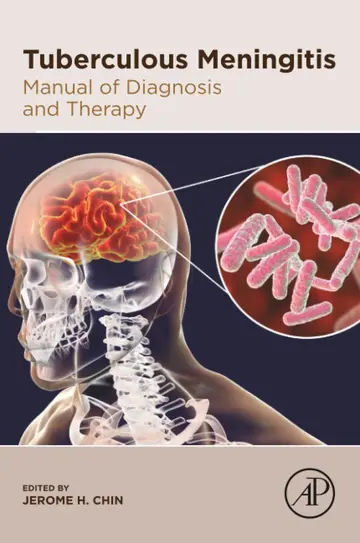 Cover of Tuberculous Meningitis