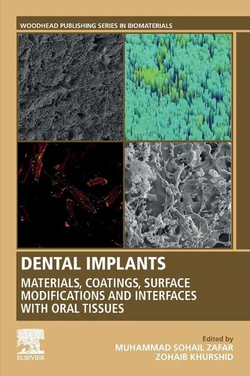 Cover of Dental Implants