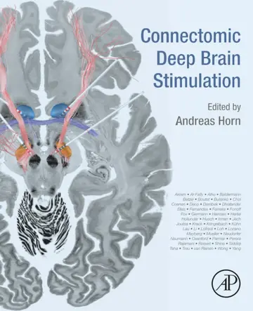 Cover of Connectomic Deep Brain Stimulation