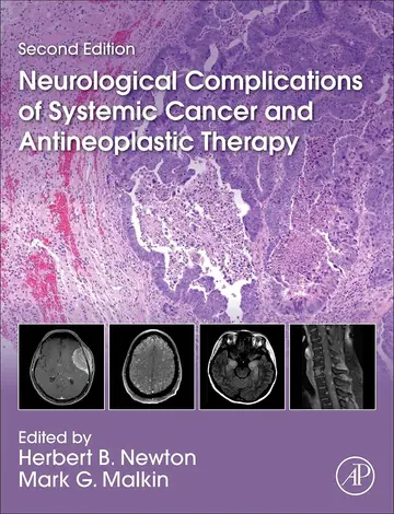 Cover of Neurological Complications of Systemic Cancer and Antineoplastic Therapy