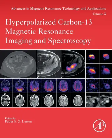 Cover of Hyperpolarized Carbon-13 Magnetic Resonance Imaging and Spectroscopy