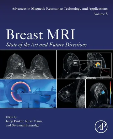 Cover of Breast MRI