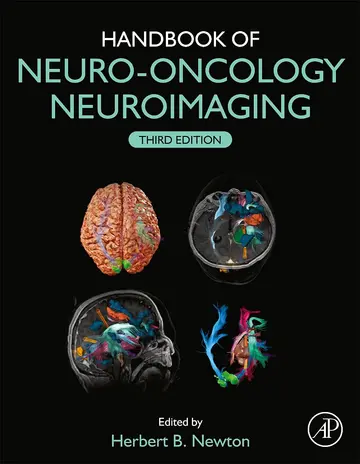 Cover of Handbook of Neuro-Oncology Neuroimaging