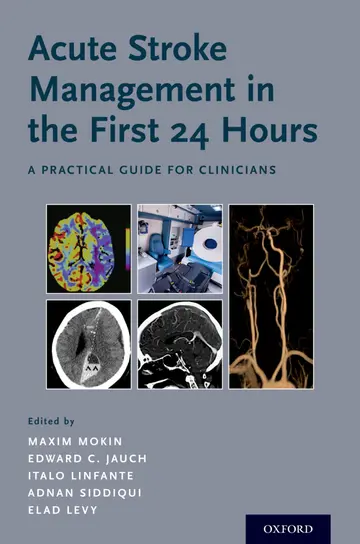 Cover of Acute Stroke Management in the First 24 Hours