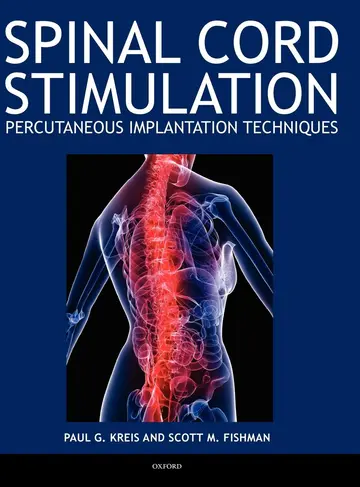 Cover of Spinal Cord Stimulation