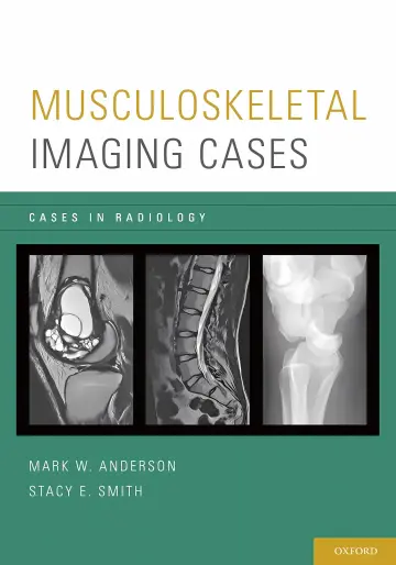 Cover of Musculoskeletal Imaging Cases