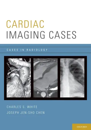 Cover of Cardiac Imaging Cases