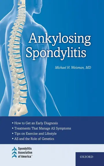 Cover of Ankylosing Spondylitis