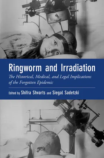 Cover of Ringworm and Irradiation