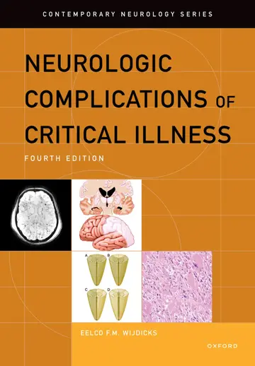 Cover of Neurologic Complications of Critical Illness