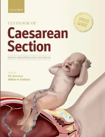 Cover of Textbook of Caesarean Section