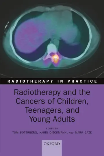 Cover of Radiotherapy and the Cancers of Children, Teenagers, and Young Adults