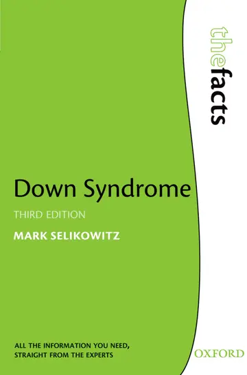 Cover of Down Syndrome