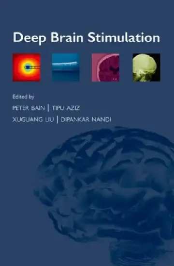 Cover of Deep Brain Stimulation