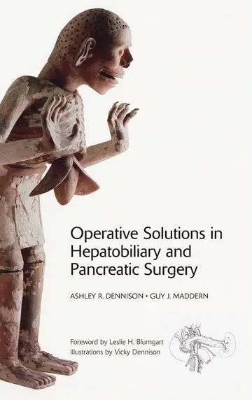 Cover of Operative Solutions in Hepatobiliary and Pancreatic Surgery