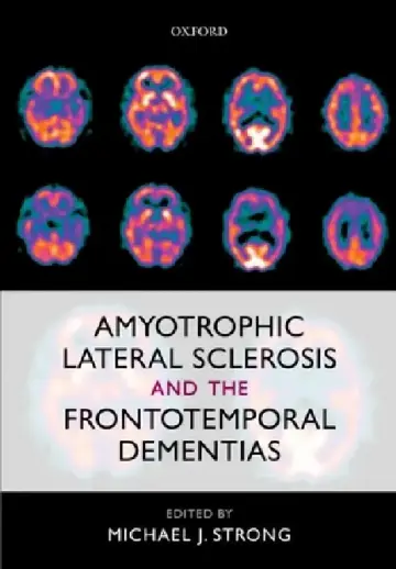 Cover of Amyotrophic Lateral Sclerosis and the Frontotemporal Dementias
