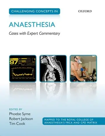 Cover of Challenging Concepts in Anaesthesia