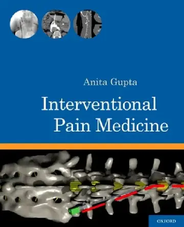 Cover of Interventional Pain Medicine