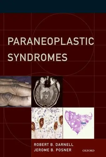 Cover of Paraneoplastic Syndromes